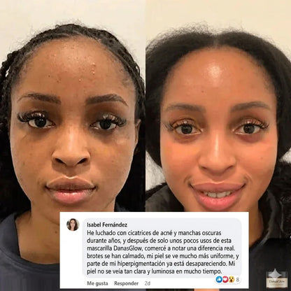 Mascarilla de Colágeno efecto Lifting